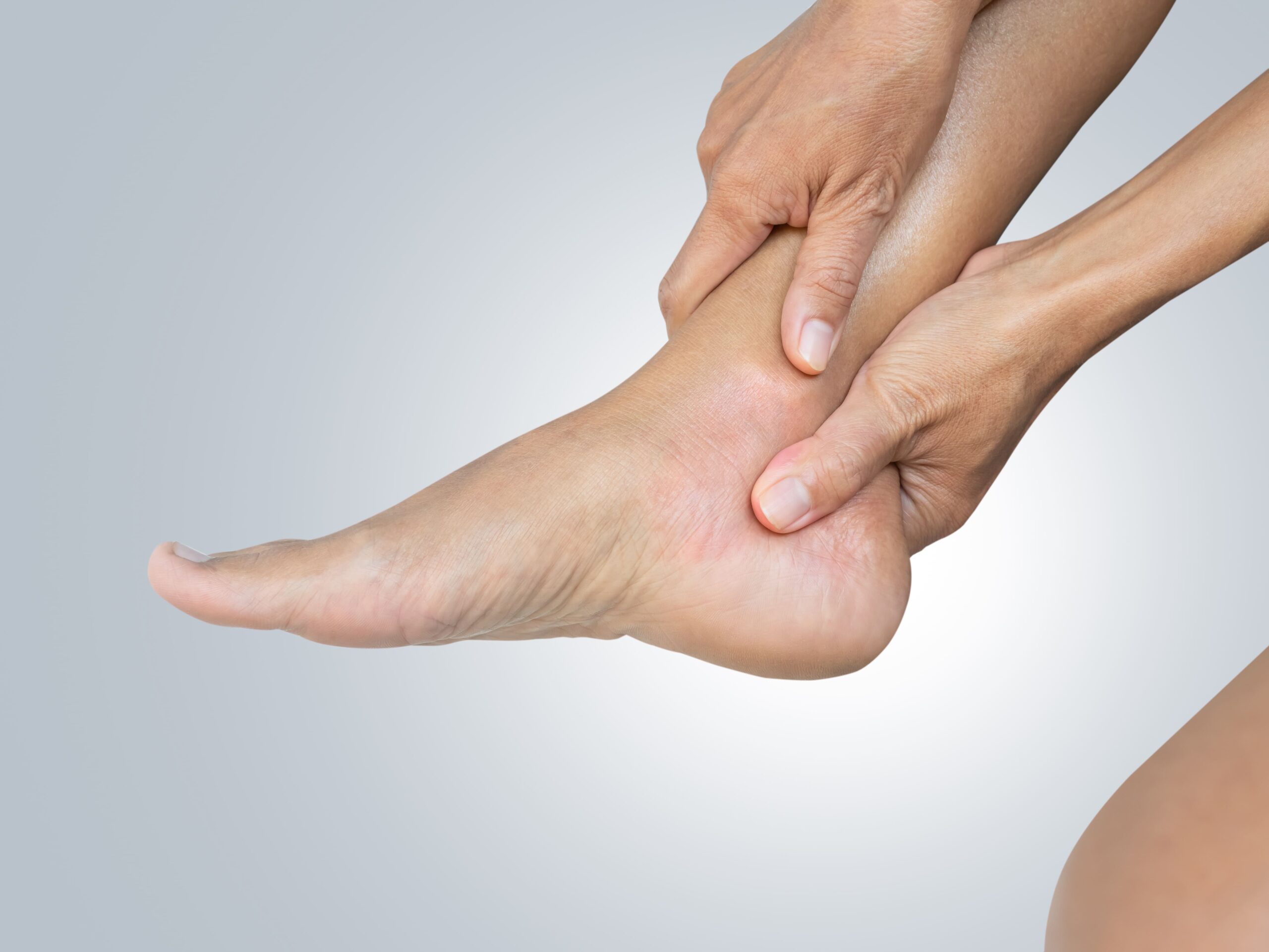 Achilles Tendonitis in Singapore