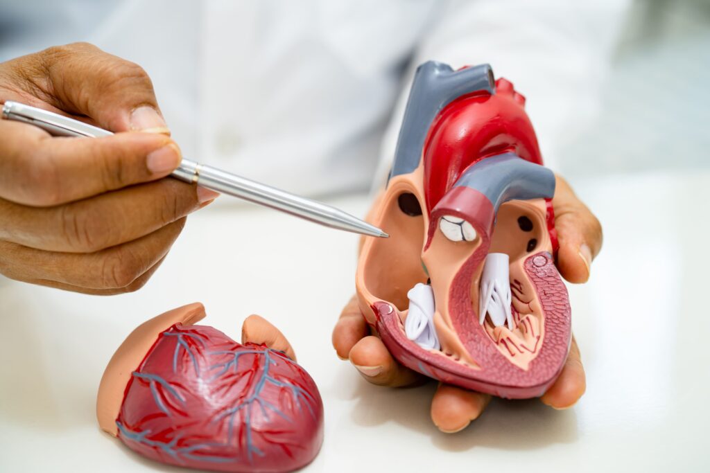 Angioplasty Procedure in Singapore