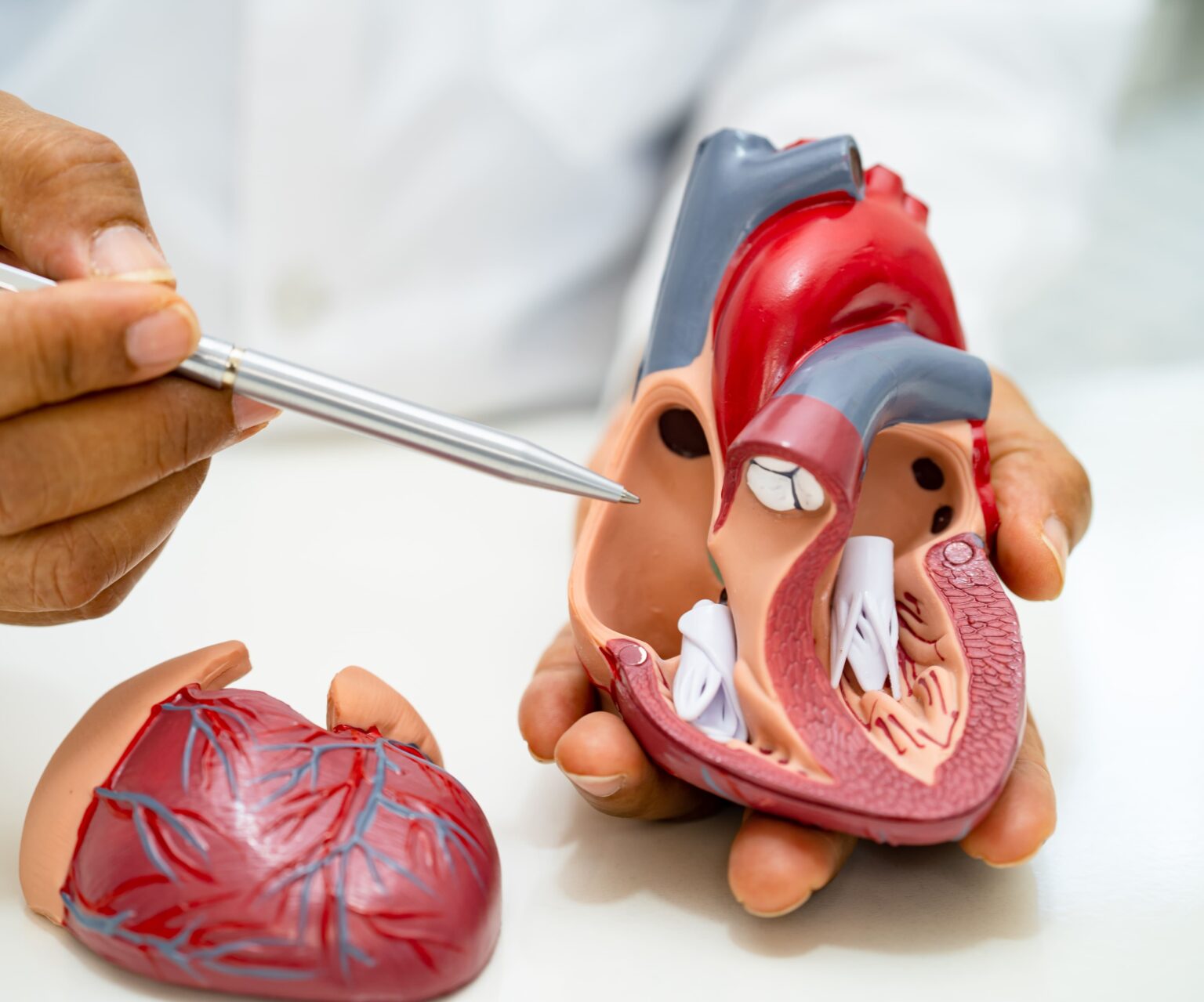 Angioplasty Procedure in Singapore
