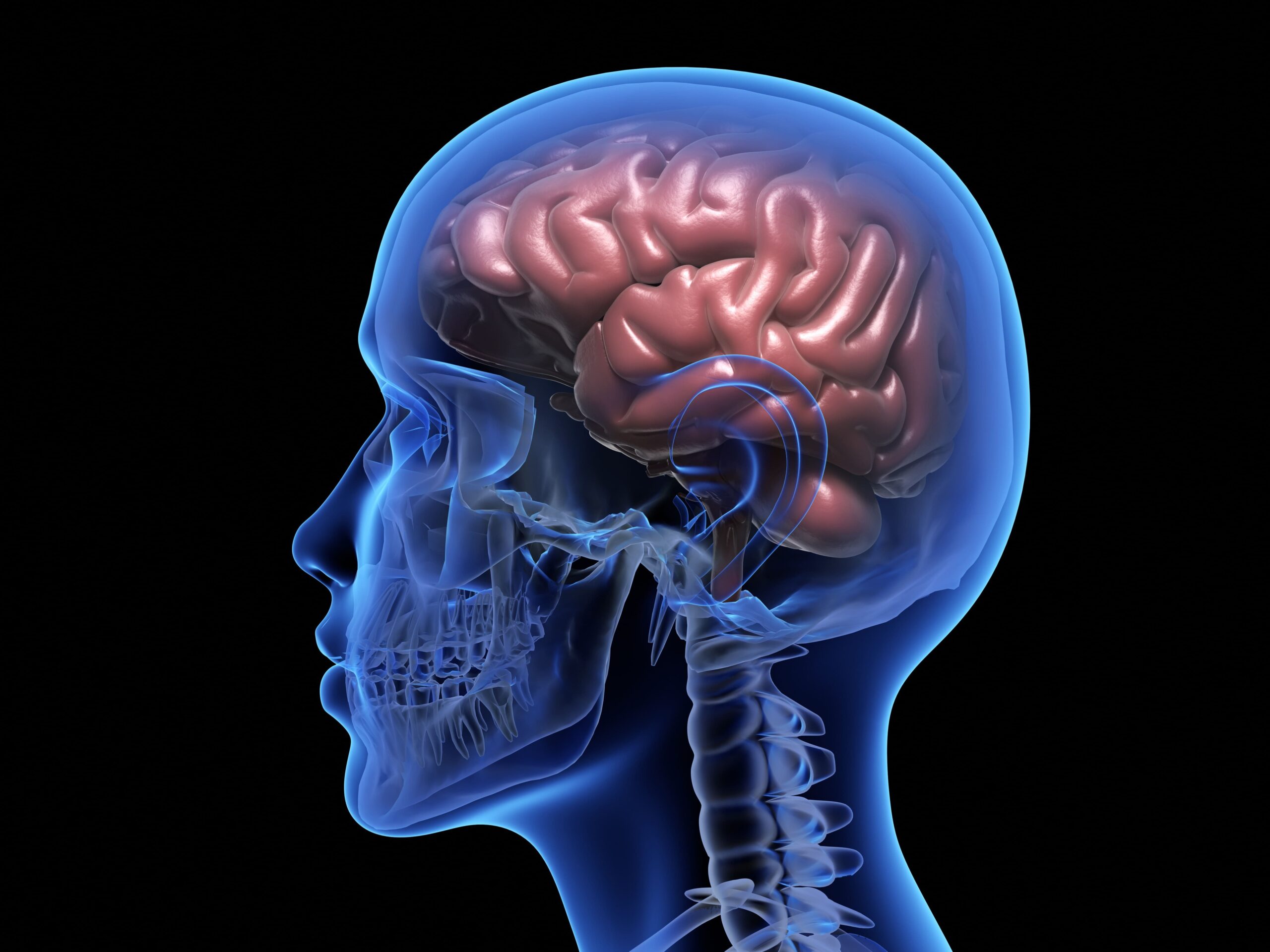 Brain Aneurysm Treatment Singapore