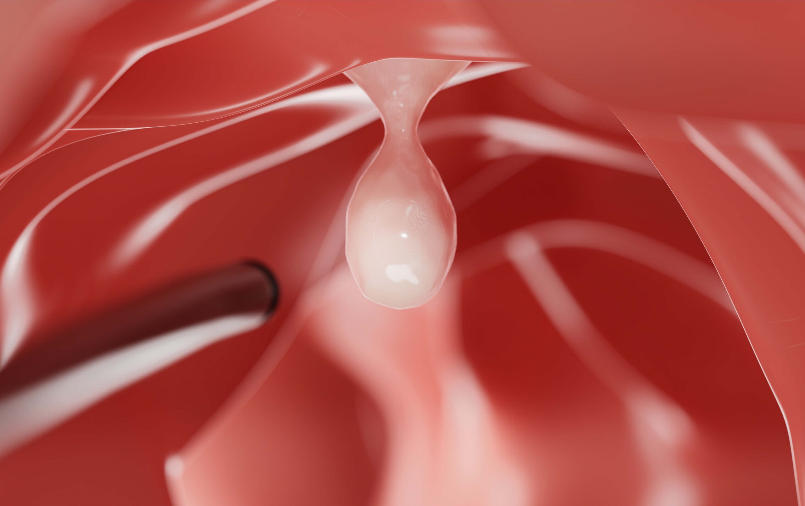 Image AHG colonoscopy m