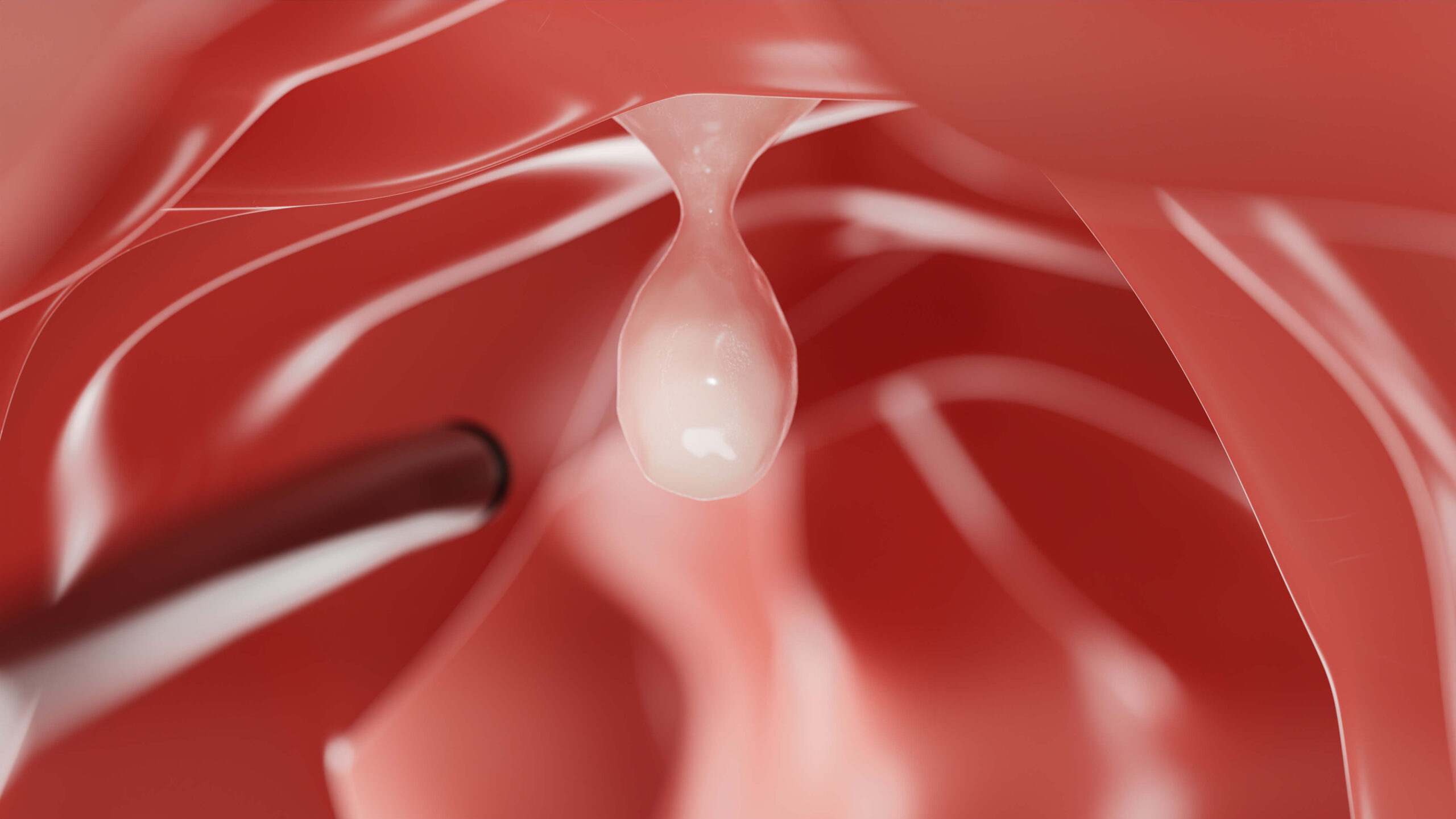Colonoscopy Singapore