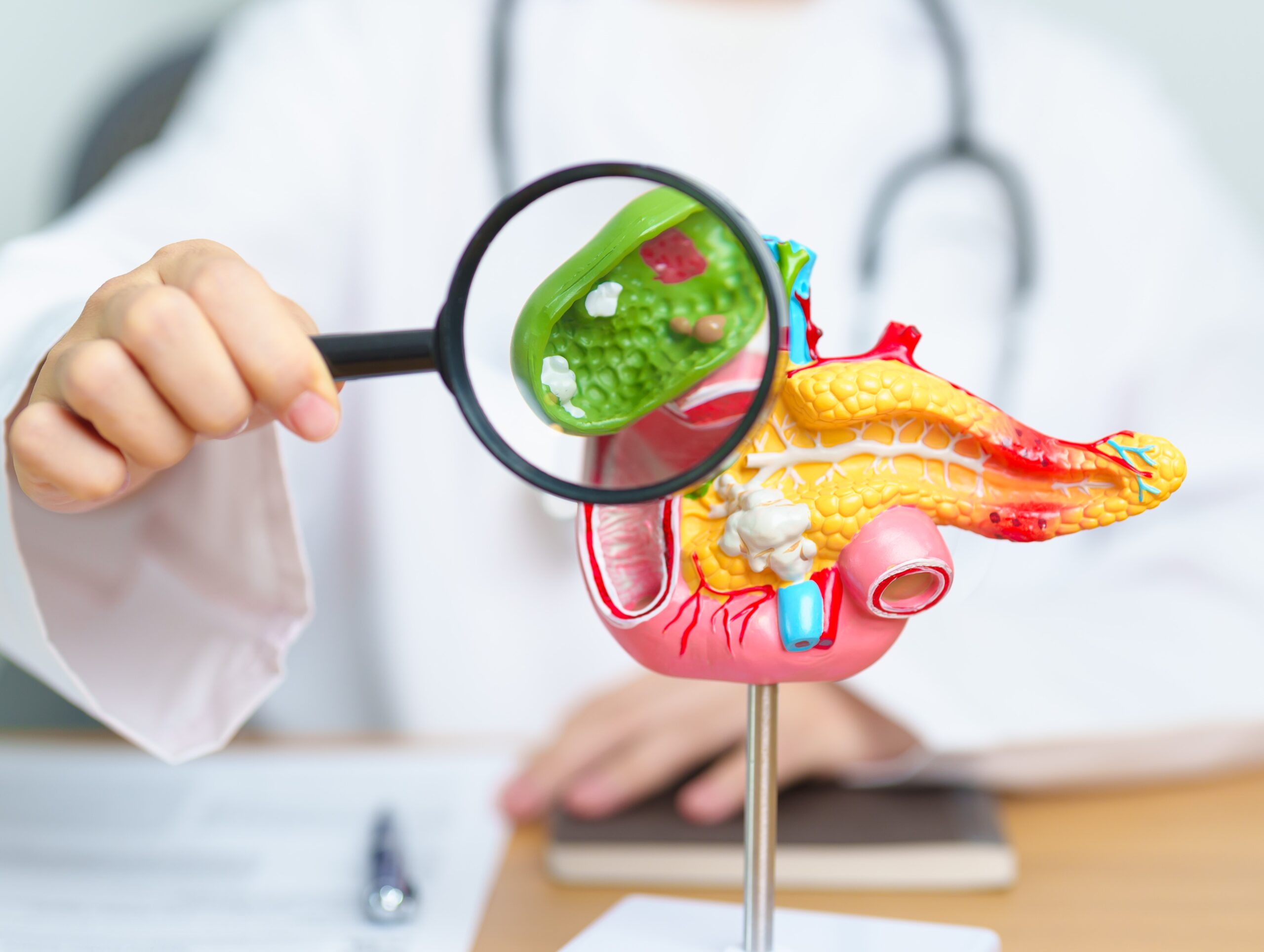 Gallstones Surgery in Singapore
