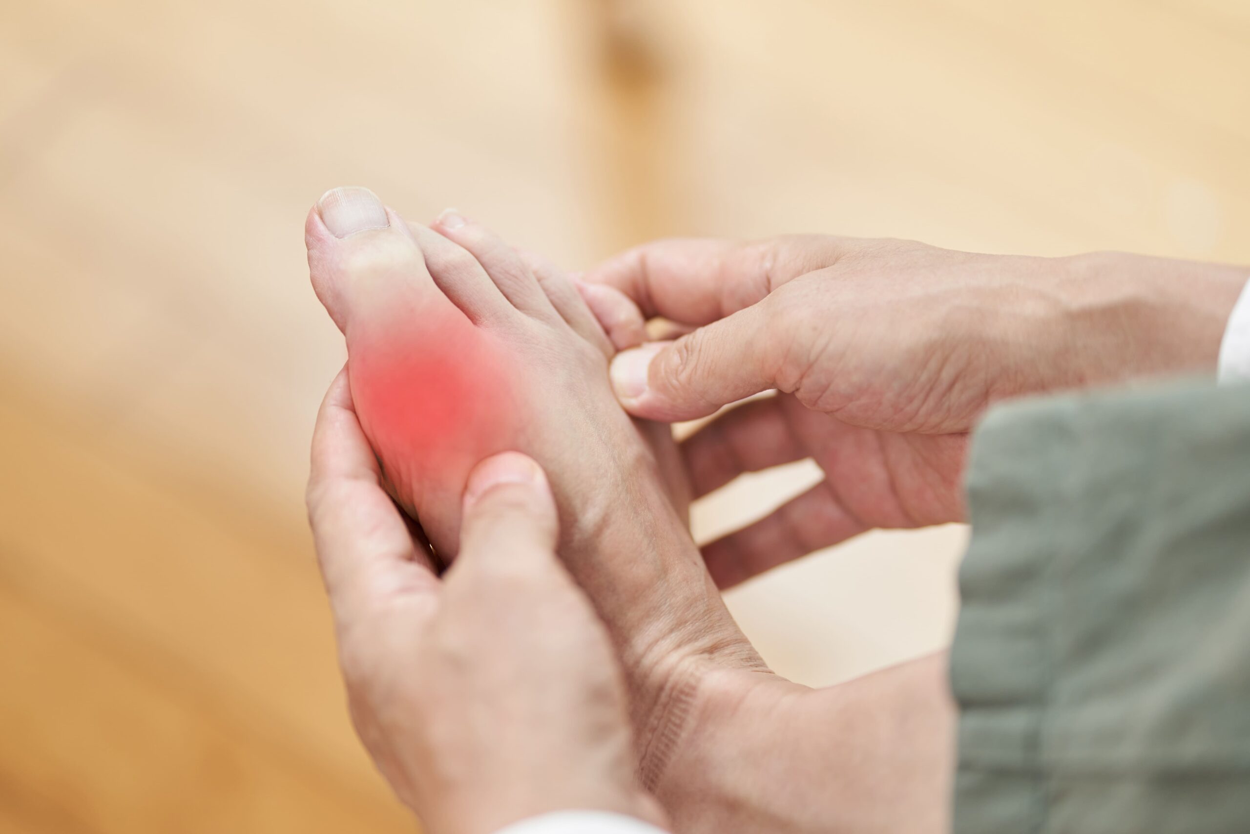 Gout Treatment in Singapore
