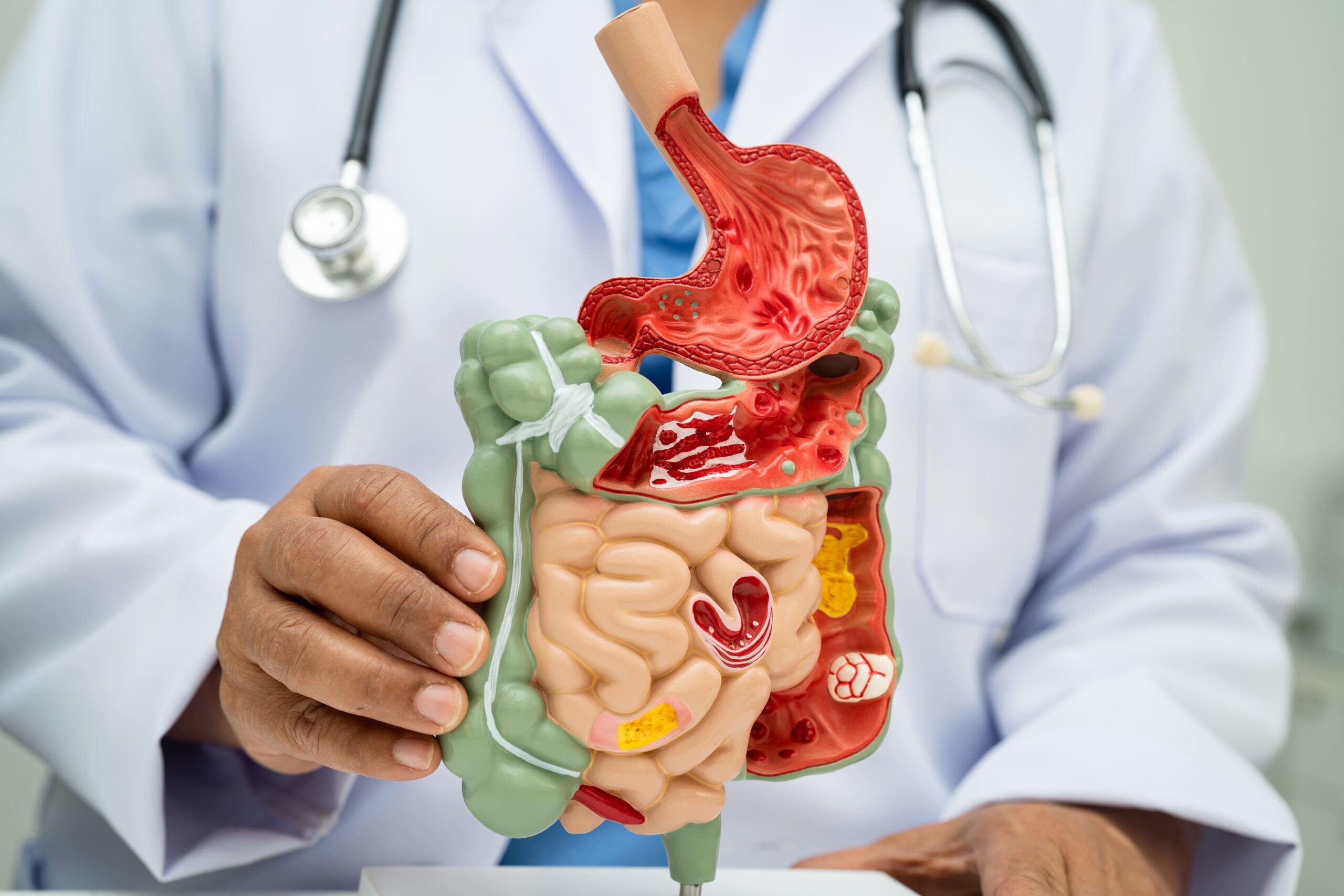 Image Gastrointestinal & Digestive Health Department