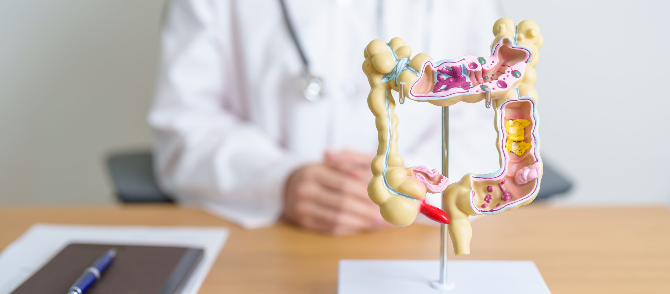Image Doctor with human Colon anatomy model. Colonic disease, Large In