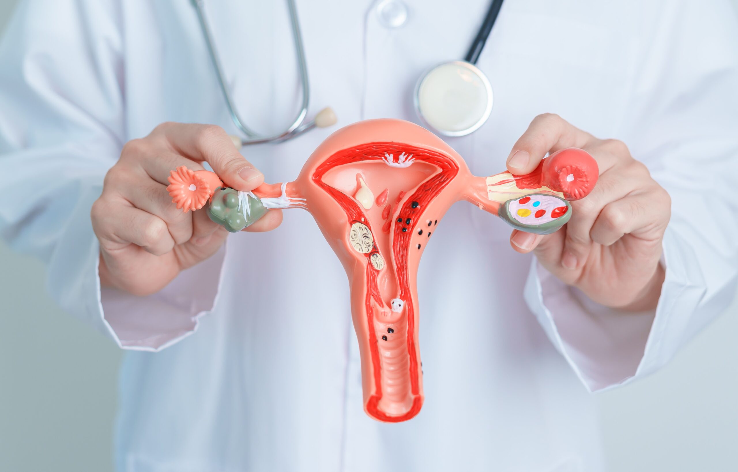 Endometriosis Singapore