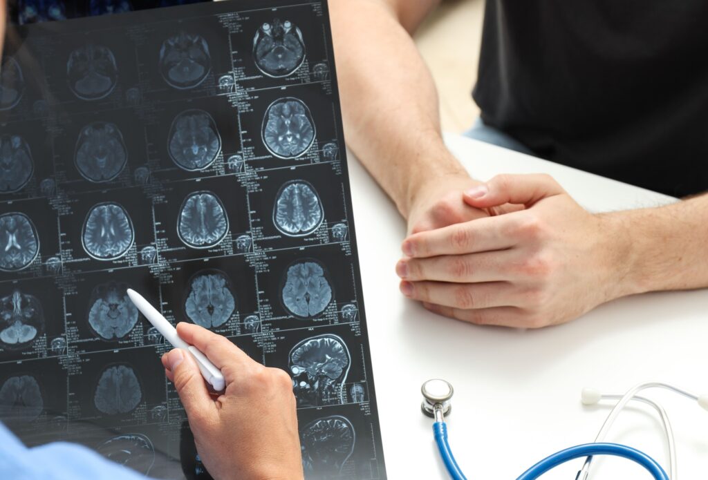 Gamma Knife Radiosurgery Singapore
