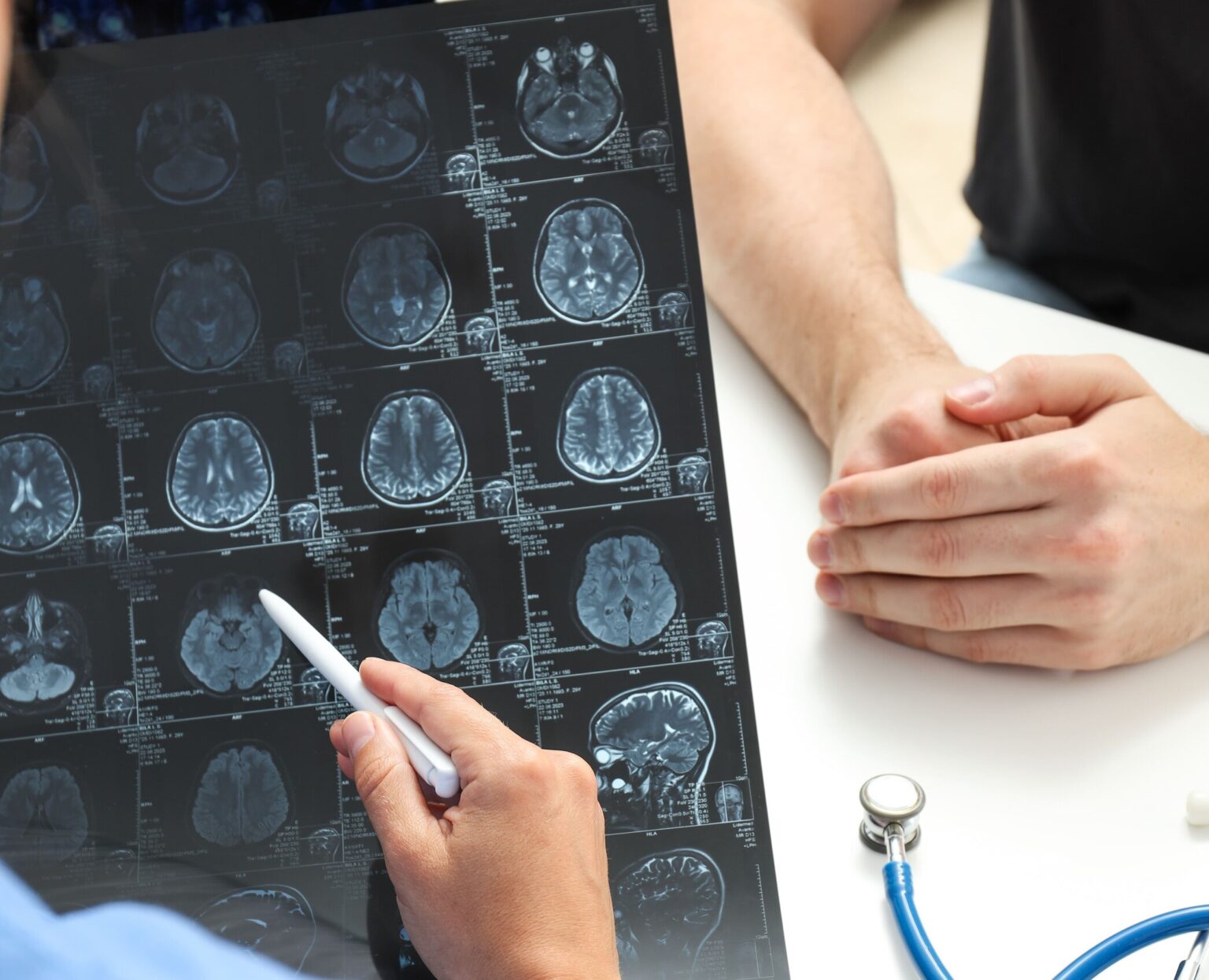 Gamma Knife Radiosurgery Singapore