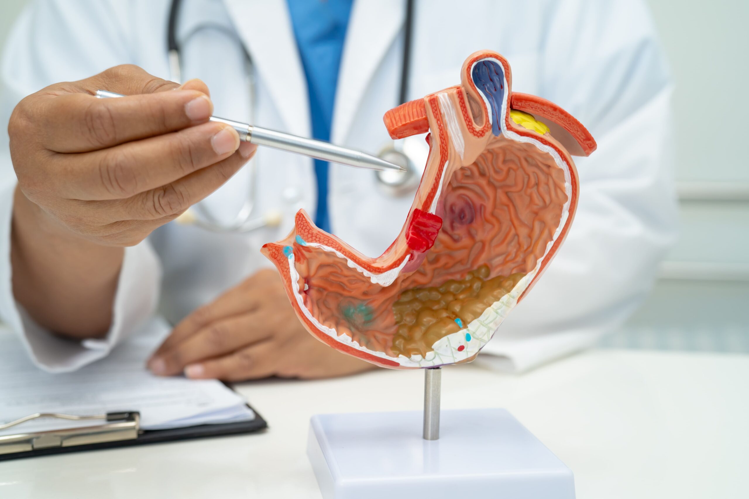 GERD Treatment in Singapore