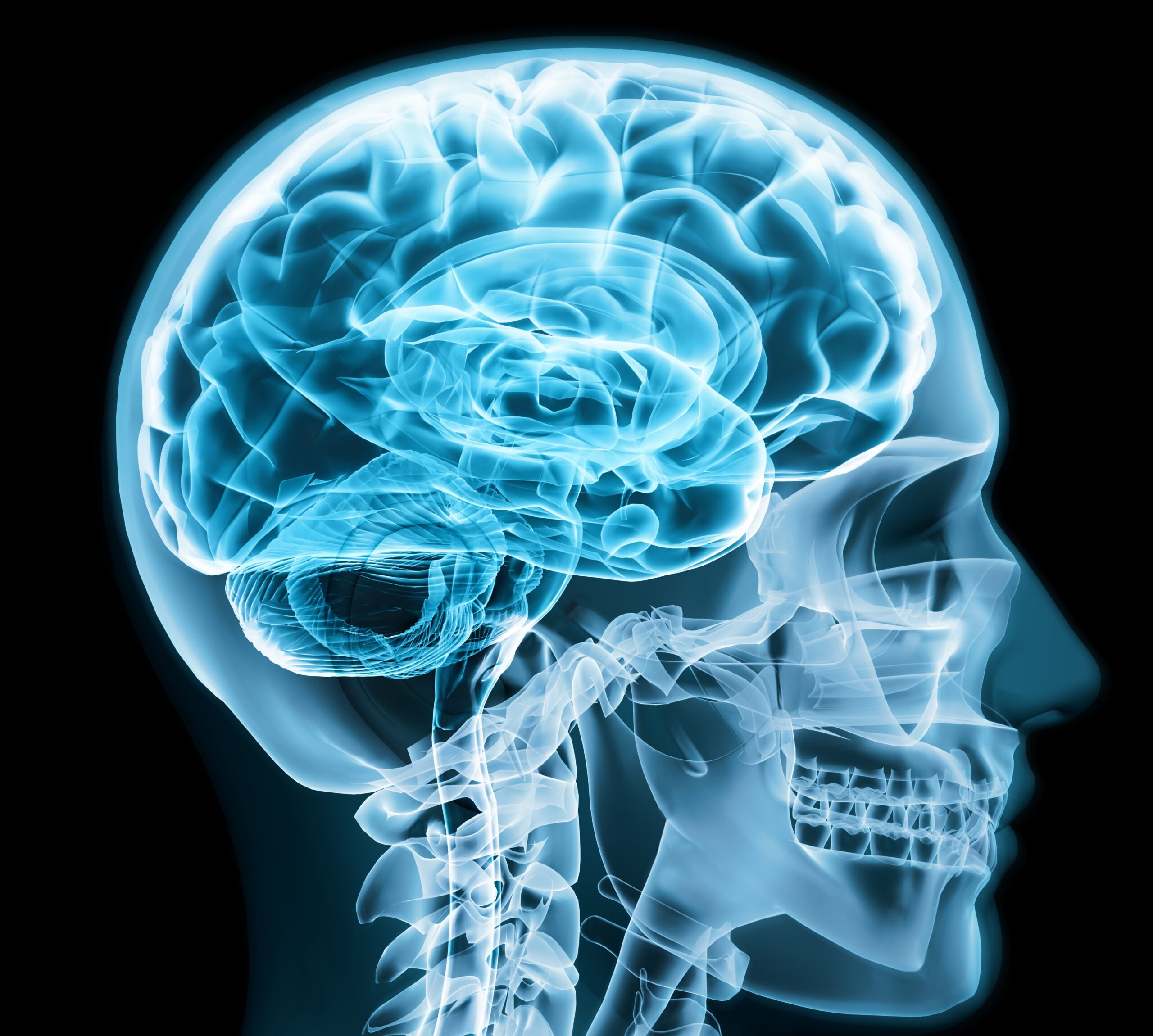 Stroke Treatment in Singapore