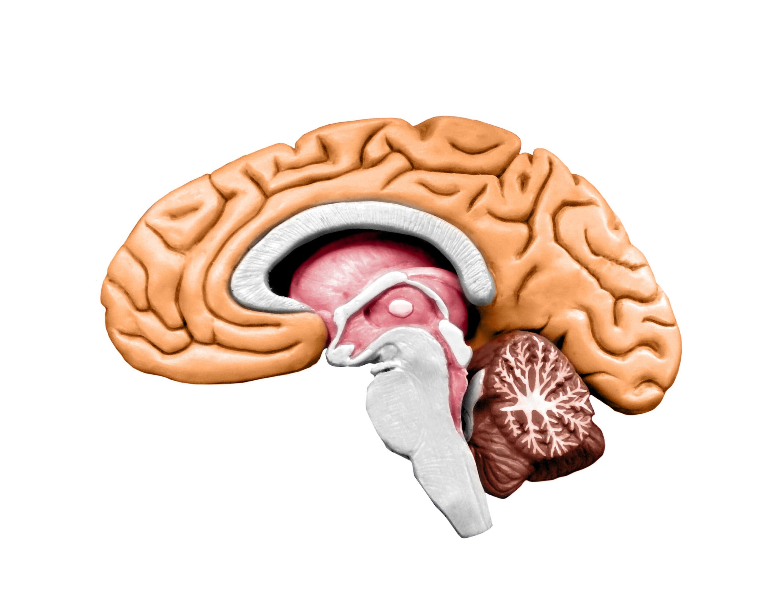 Hydrocephalus in Singapore