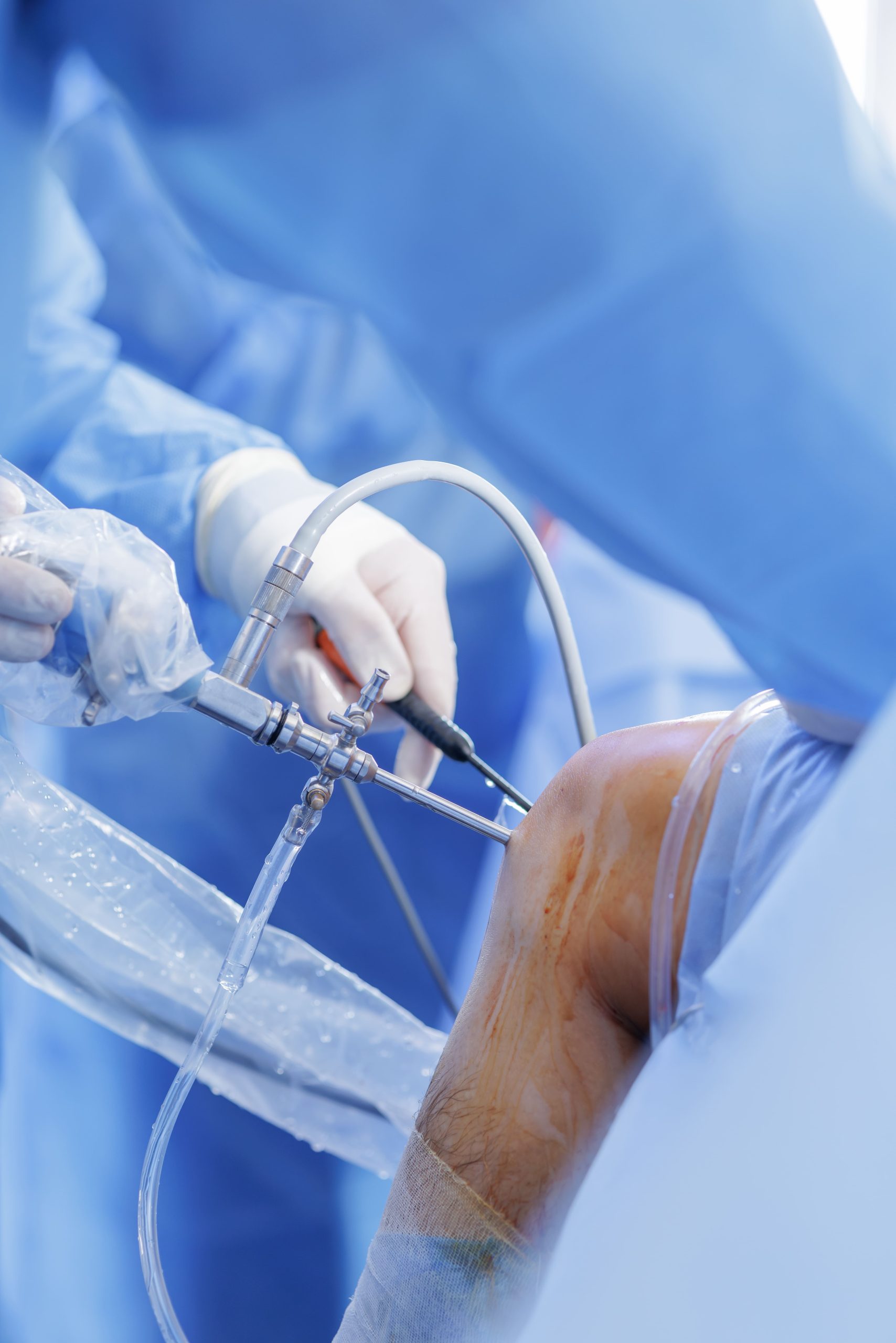 Image arthroscopic surgery with surgical tools on knee 2026 01 08 08 15 04 utc (1)