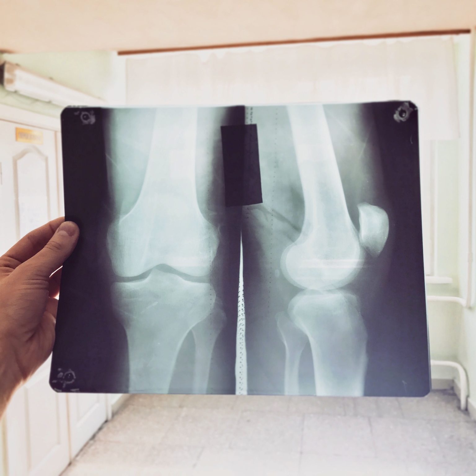 Image knee x ray medical diagnostic imaging in hospital 2026 03 09 08 44 56 utc (1)